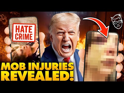 Ohio Black Mob Attack Shocker: First Victim Photos Revealed - American